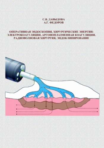 Оперативная эндоскопия, хирургические энергии