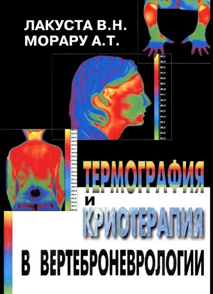 Термография и криотерапия в вертеброневрологии